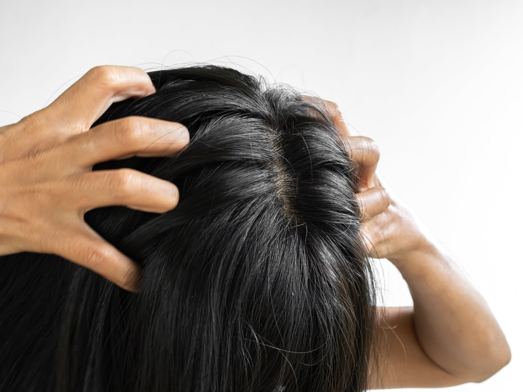 Itchy Scalp? The Natural Causes and Fixes That Actually Work