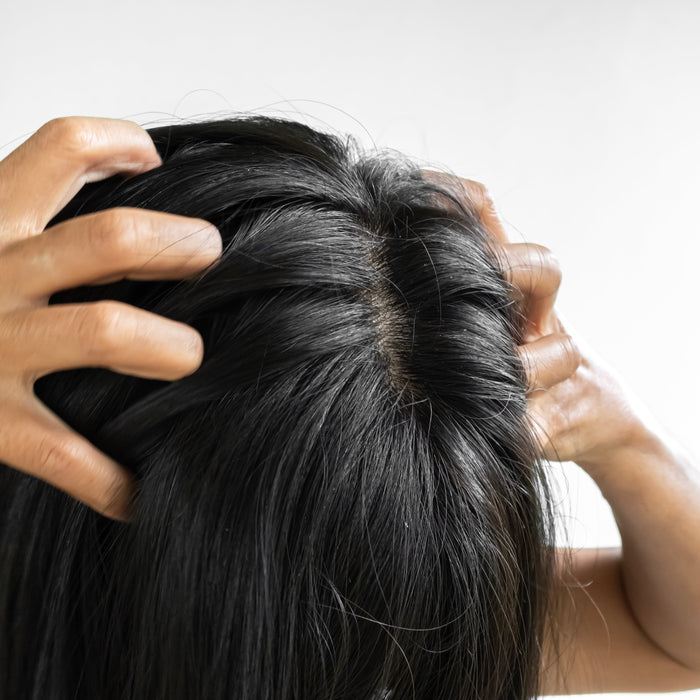 Itchy Scalp? The Natural Causes and Fixes That Actually Work